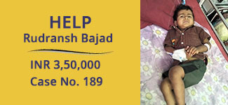 rudranch-bajad-medical-case
