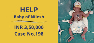 baby-of-nilesh-medical-cases