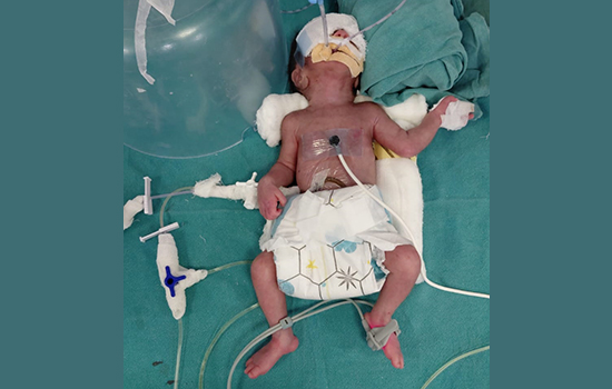 baby-of-nilesh