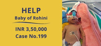 baby-of-rohini-medical-cases