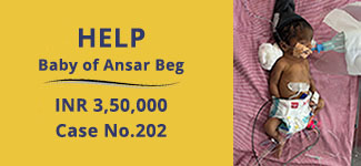 baby-of-ansar-medical-cases