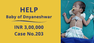 baby-of-dnyaneshwar-medical-cases